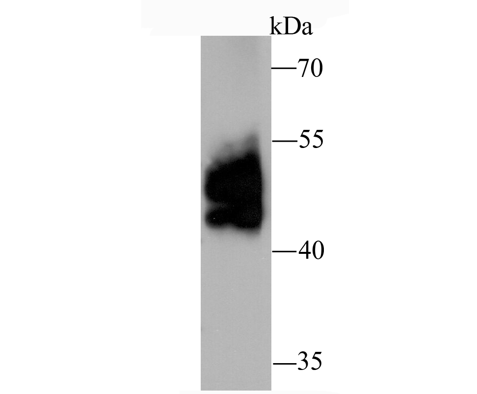CD274(PD1L1) Antibody