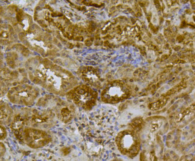 SIRT3 Antibody