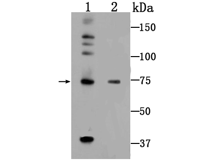 5 Lipoxygenase Antibody