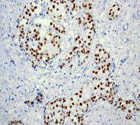 Estrogen Receptor alpha Antibody