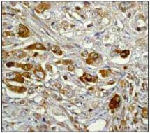 IkappaB alpha Antibody