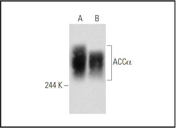 Acetyl CoA Carboxylase 1 (ACC1) Antibody