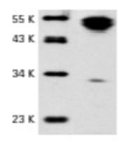 CD95 / Fas Antibody