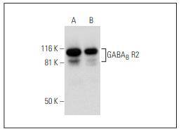 GABA(B) R2 Antibody