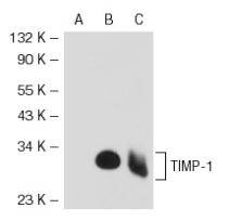 TIMP-1 Antibody