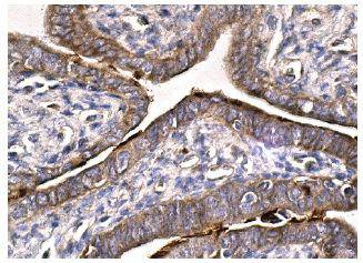 VEGFR-1 Antibody