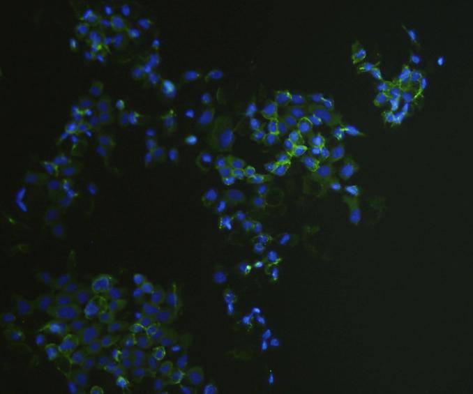 EP-CAM Antibody