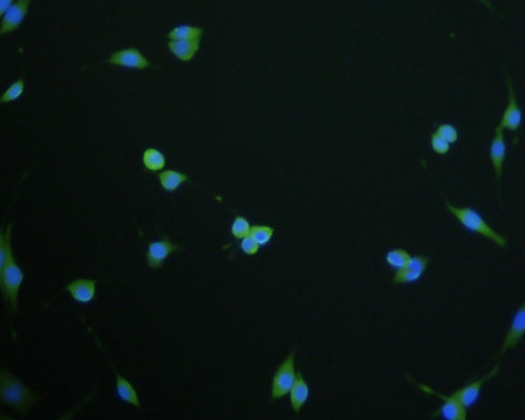 LNP Antibody