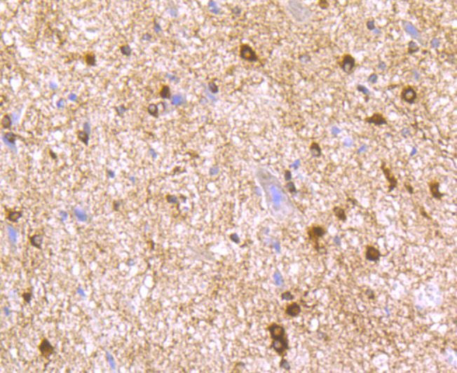 LNP Antibody