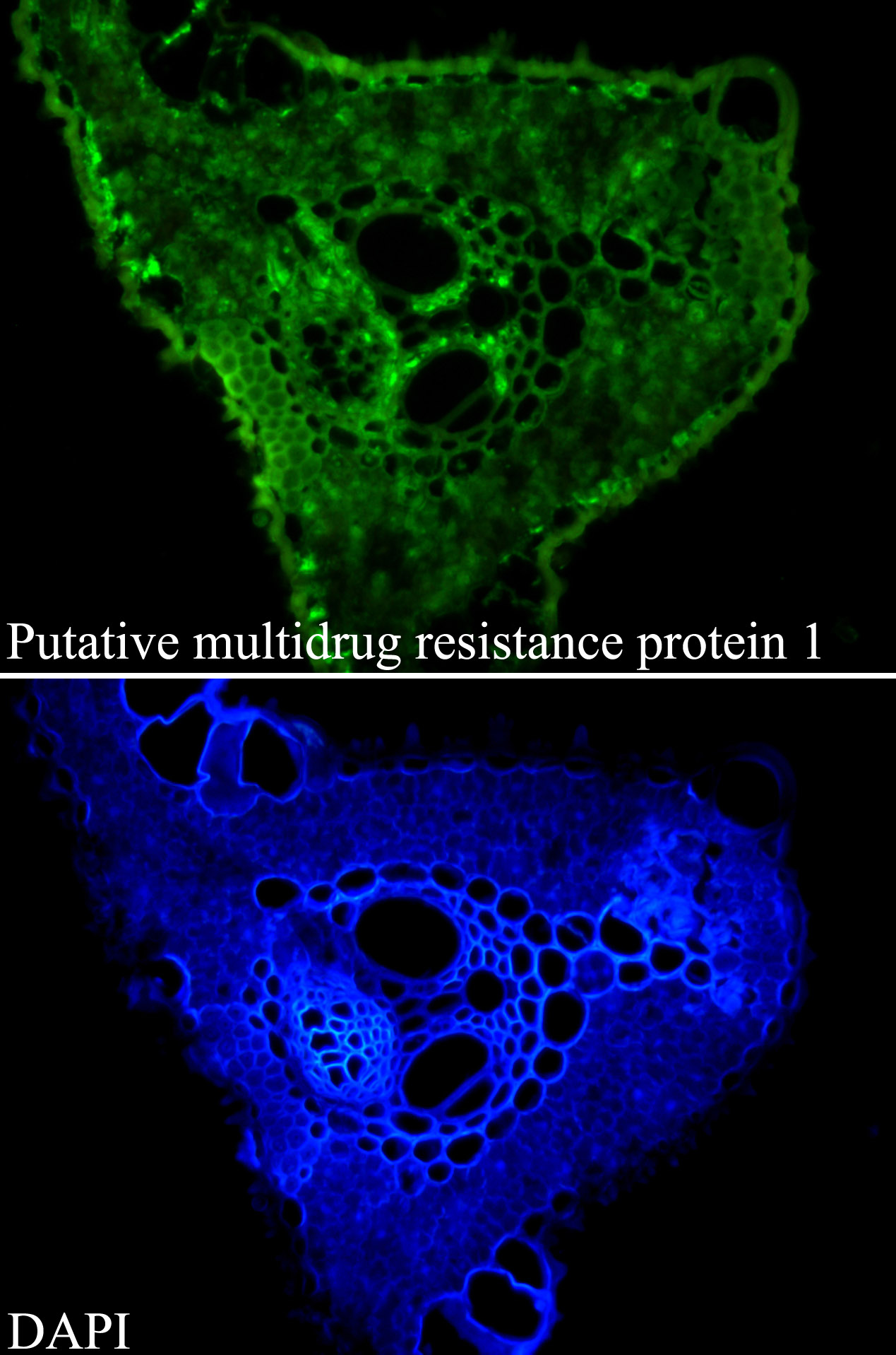 Putative multidrug resistance protein 1 Antibody