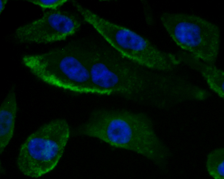 Gp83 Antibody
