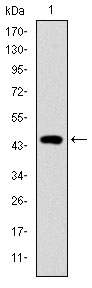 TNNI2 Antibody