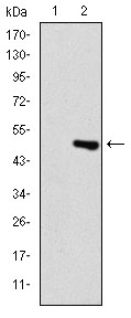 TNNI2 Antibody