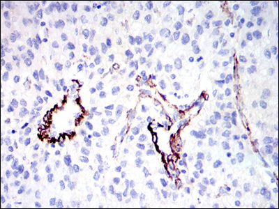 GKAP Antibody