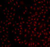 Bmi1 Antibody