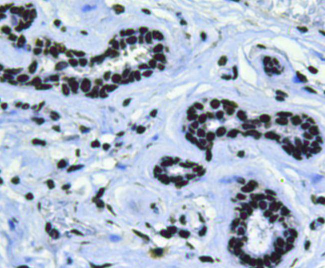 Bmi1 Antibody