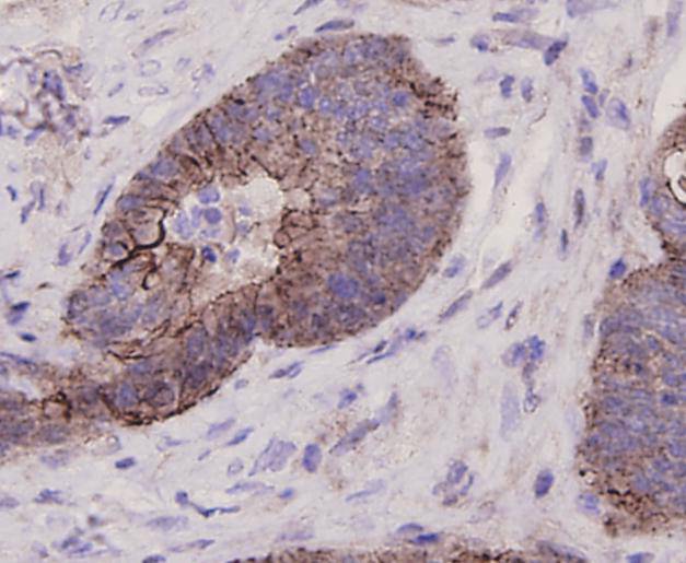 GPR49/LGR5 alpha/beta Antibody