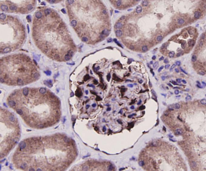 ERK2 Antibody