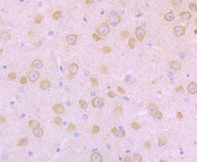 NaV1.8 Antibody