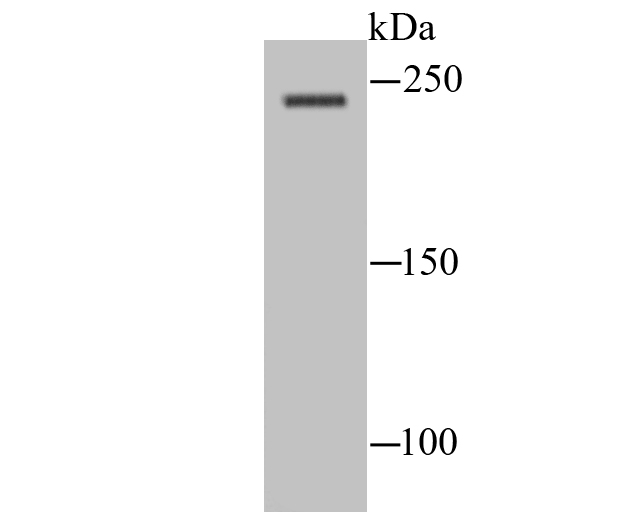 NaV1.8 Antibody