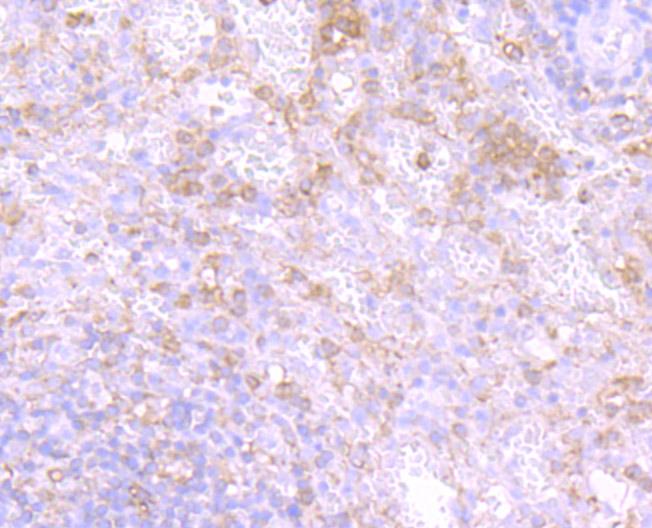 PKC beta Antibody
