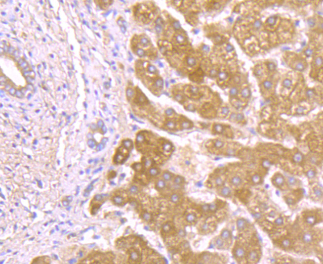 Alpha-1 acid glycoprotein Antibody