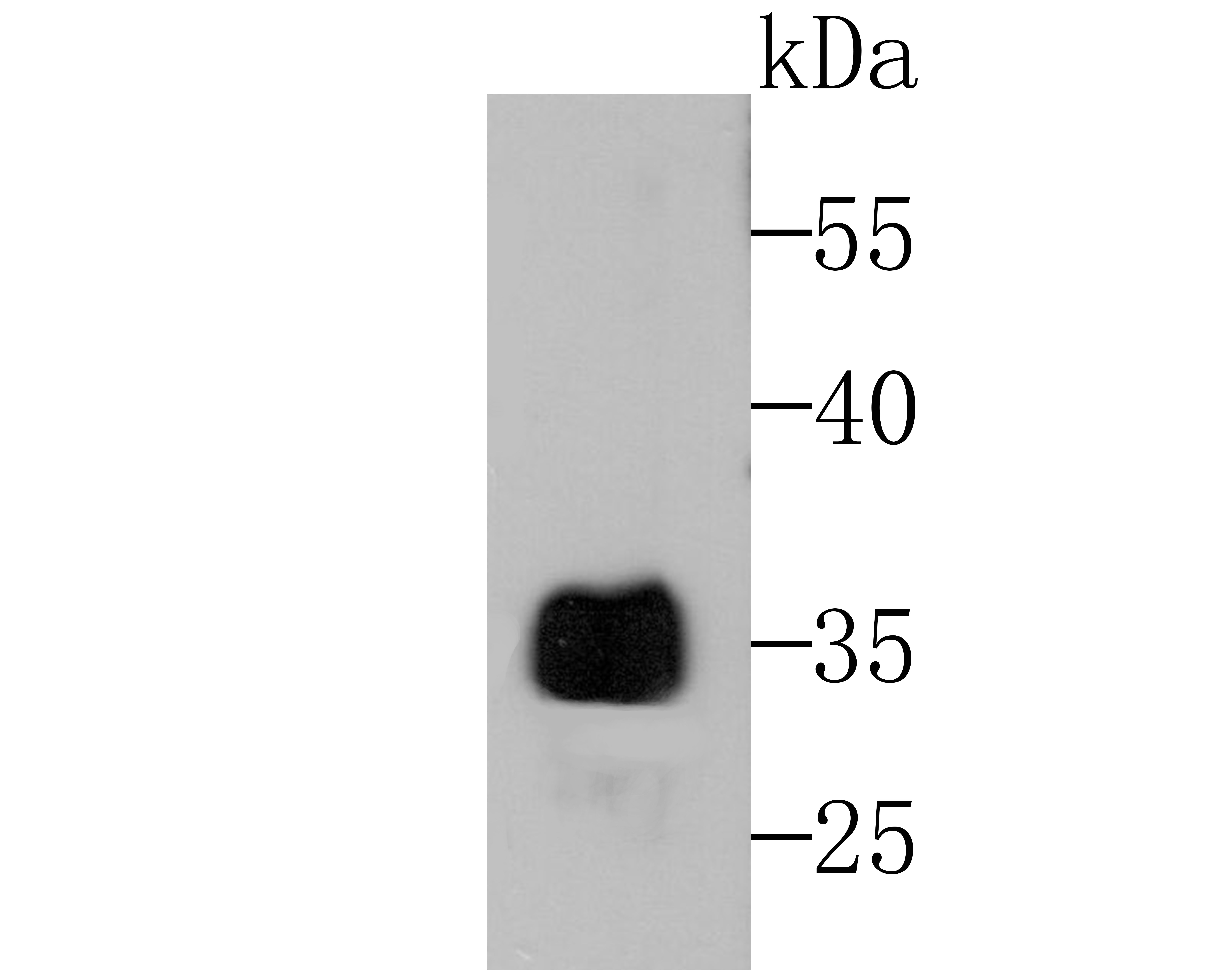 Alpha-1 acid glycoprotein Antibody
