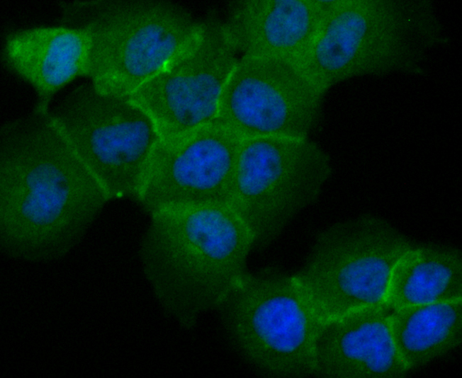 TROP2 Antibody