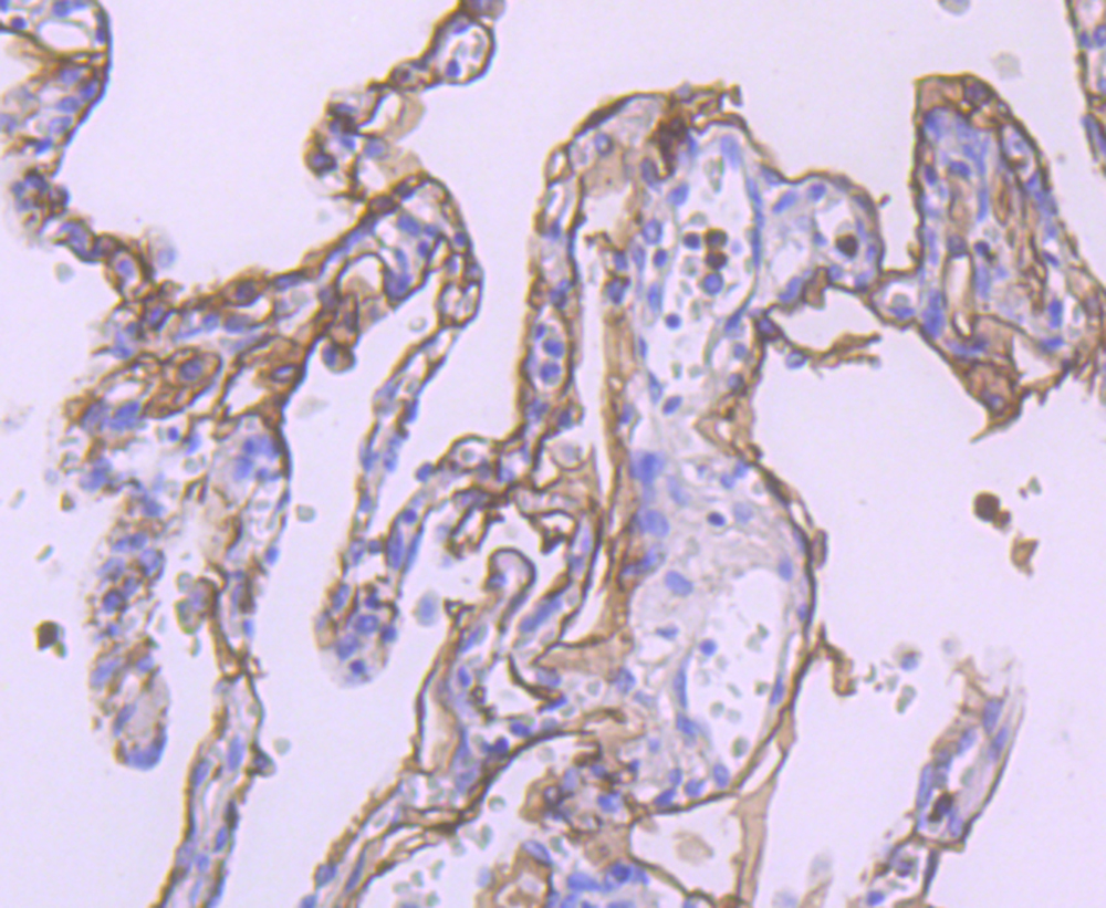 TROP2 Antibody