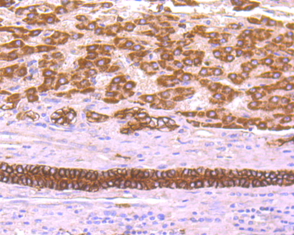 TROP2 Antibody