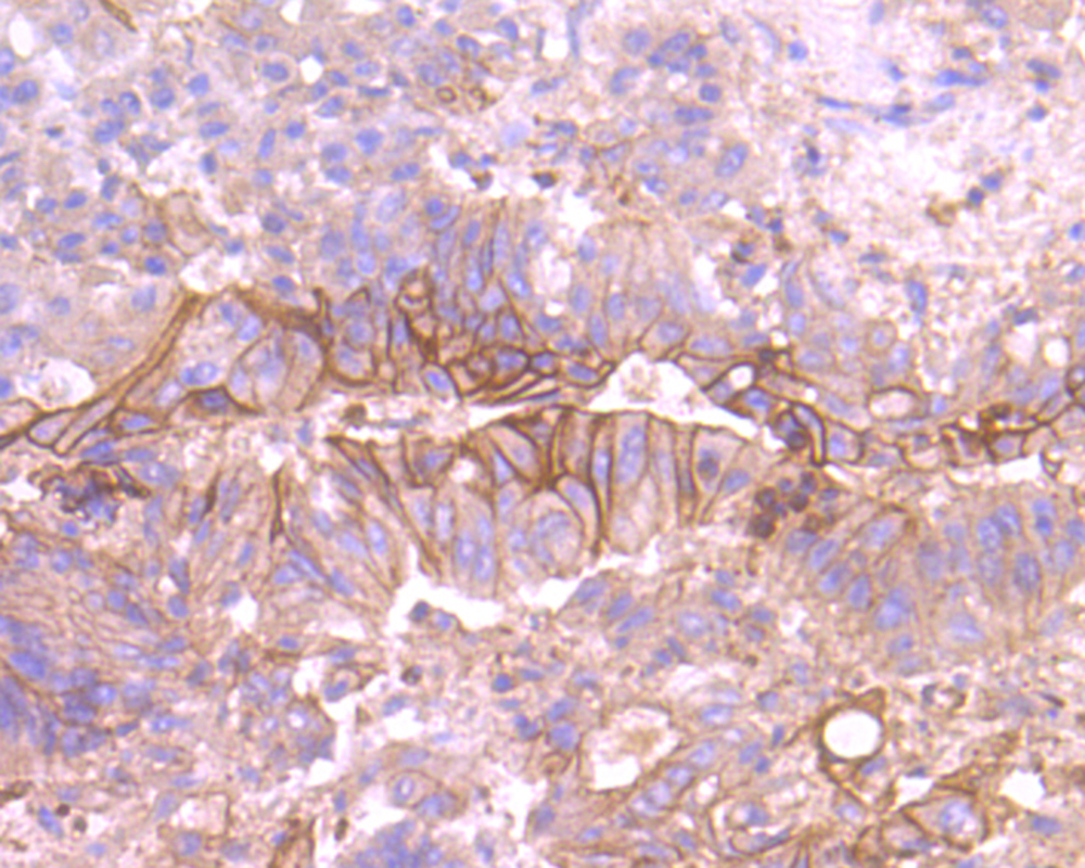 TROP2 Antibody