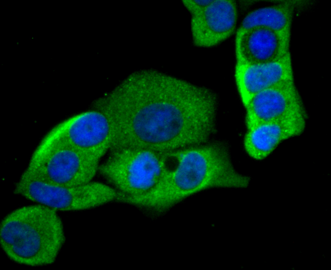HKDC1 Antibody