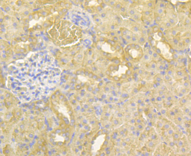 HKDC1 Antibody