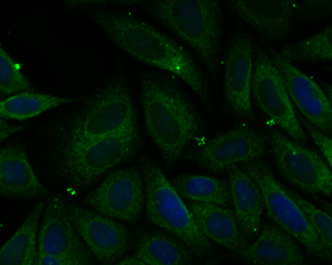 PHF8 Antibody