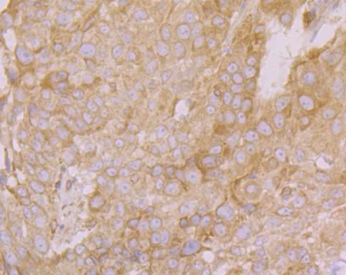 PHF8 Antibody