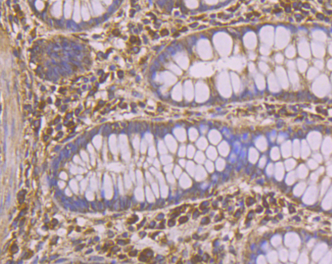 PHF8 Antibody