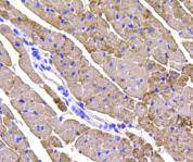 Cardiac Troponin /TTNNT2 Antibody