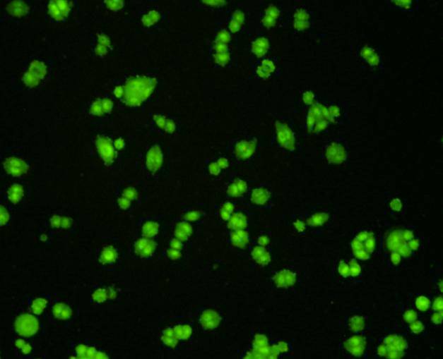 VCP Antibody