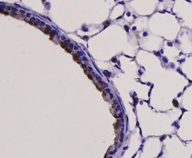 TLR7 Antibody