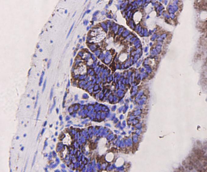 PUMA Antibody