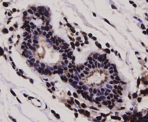 Stat-1 alpha/beta Antibody