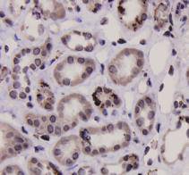 Stat-1 alpha/beta Antibody
