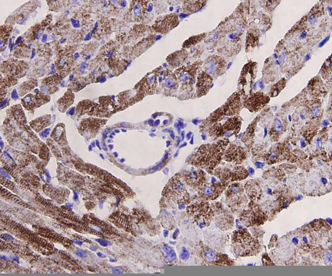 Desmin Antibody