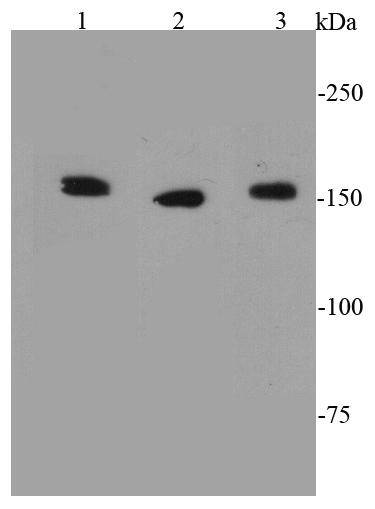 ROCK1 Antibody