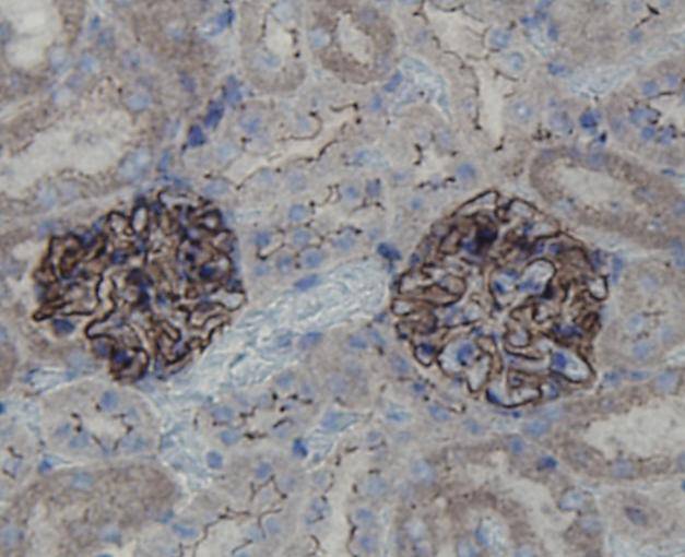 ZO1 Antibody