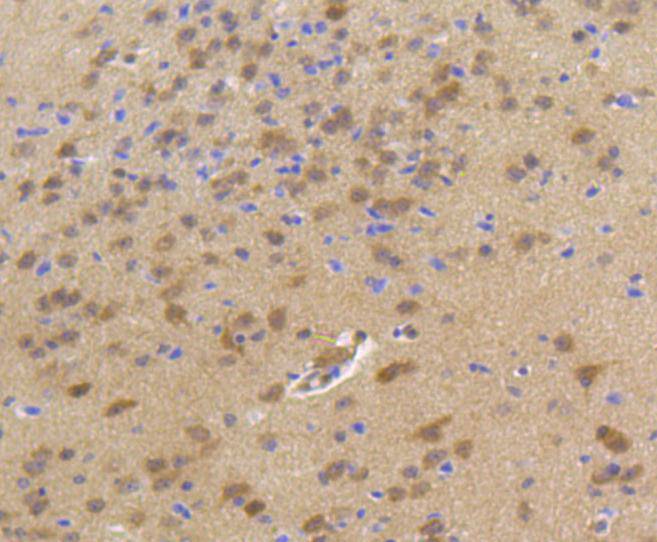 Hsp70 Rabbit mAb
