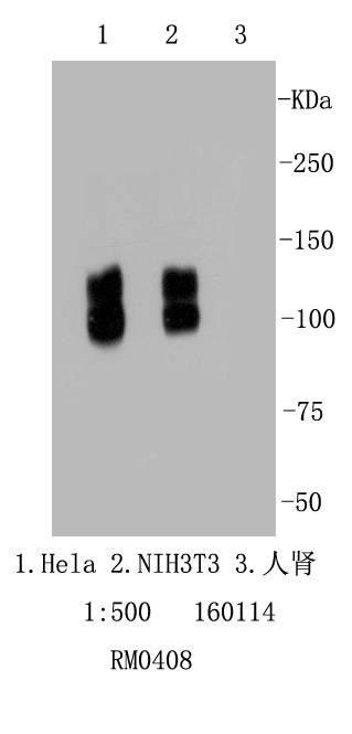 Integrin beta 1 Rabbit mAb