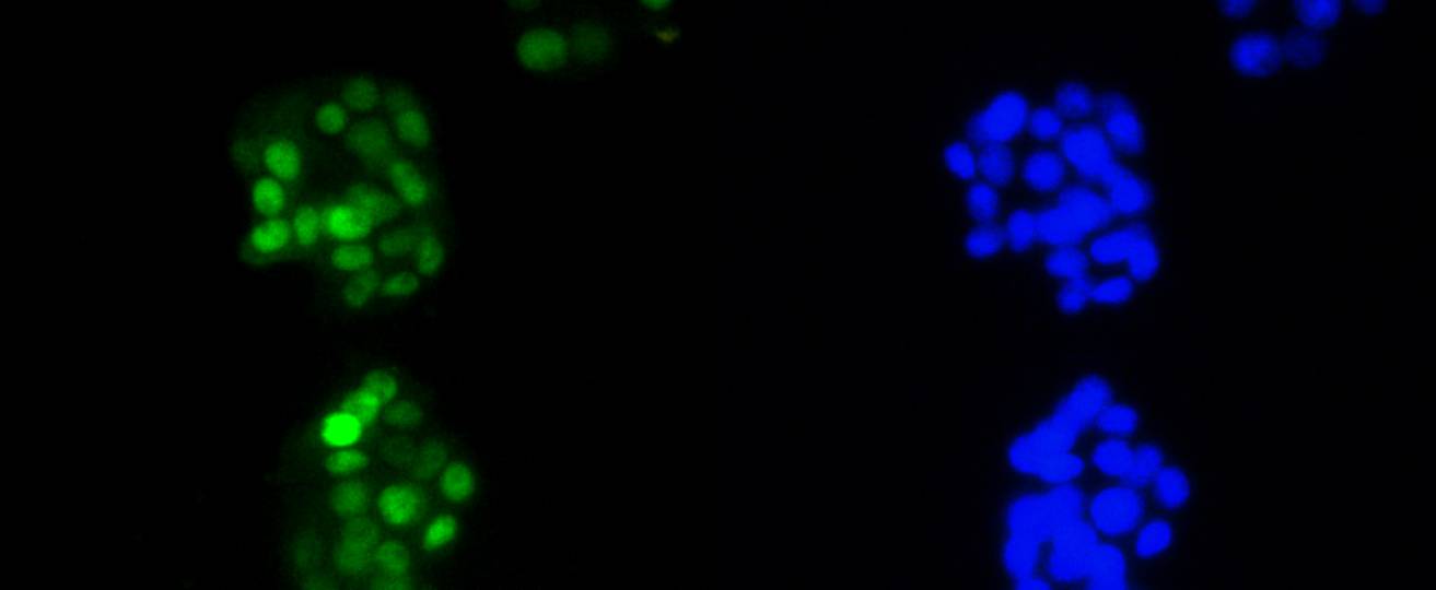 Cyclin D1 Rabbit mAb