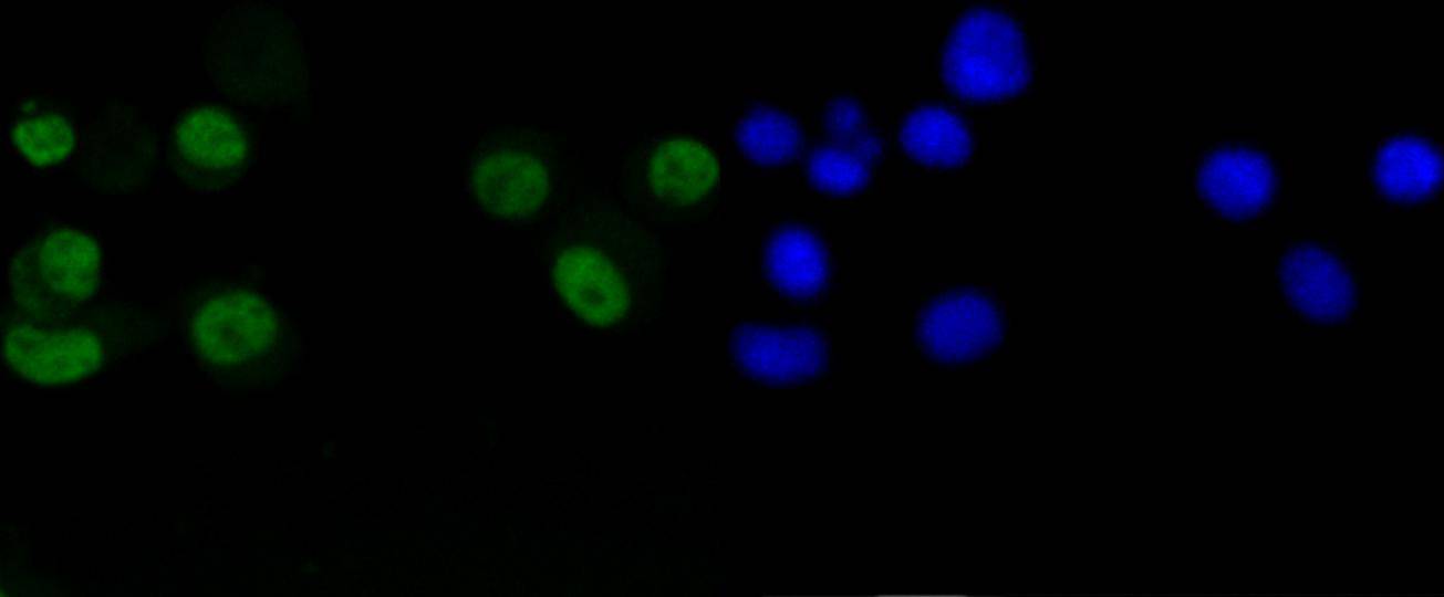 Cyclin D1 Rabbit mAb