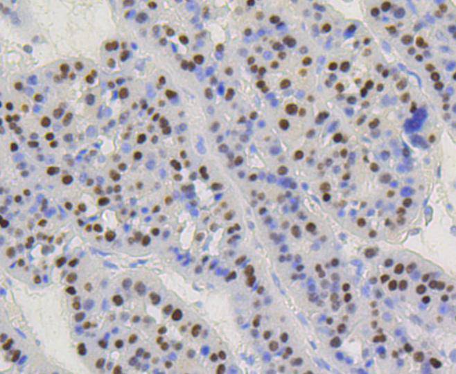 Cyclin D1 Rabbit mAb